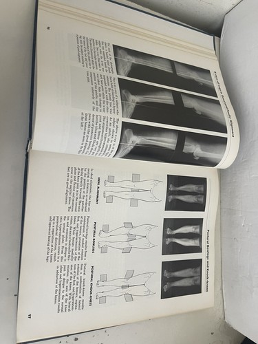 Muscles : Testing and Function by Patricia Provance Hardcover 1983 3rd Edition - Picture 10 of 16