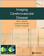 Imaging Cerebrovascular Disease, Viken L. Bab...