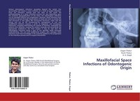 Maxillofacial Space Infections Of Odontogenic Origin Gagan Thakur