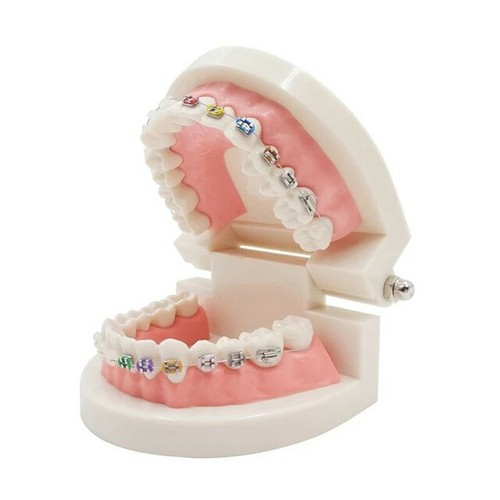 Dental Ortho Treatment Model With Metal/Ceramic Brackets Arch Wires Buccal Tubes - Picture 3 of 7