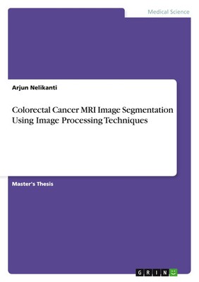 Arjun Nelikanti | Colorectal Cancer MRI Image Segmentation Using Image...