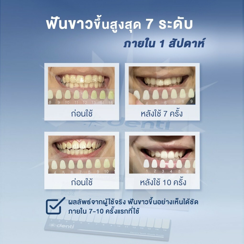 Denti Teeth Whitening Kit+teeth whitening gel 4 sticks