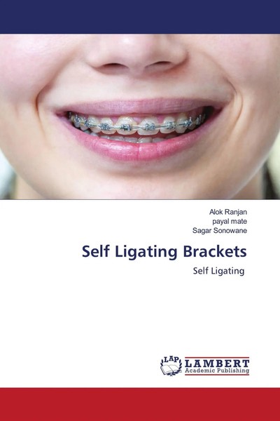 Alok Ranjan (U. A.) | Self Ligating Brackets | Taschenbuch | Englisch (2021)-image