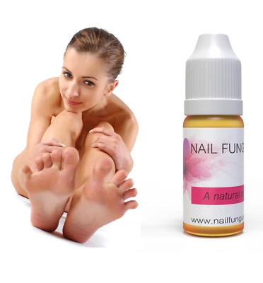 NAIL FUNGUS ZAP™ BESTE Nagelpilz KUR Zehennagel Fingernagelpilz Behandlung SICHER SCHNELL WIRKEND UK