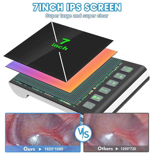Digital Otoscope with 7 Inch IPS Screen Ear Inspection Camera Wax Removal Tool - Picture 2 of 11