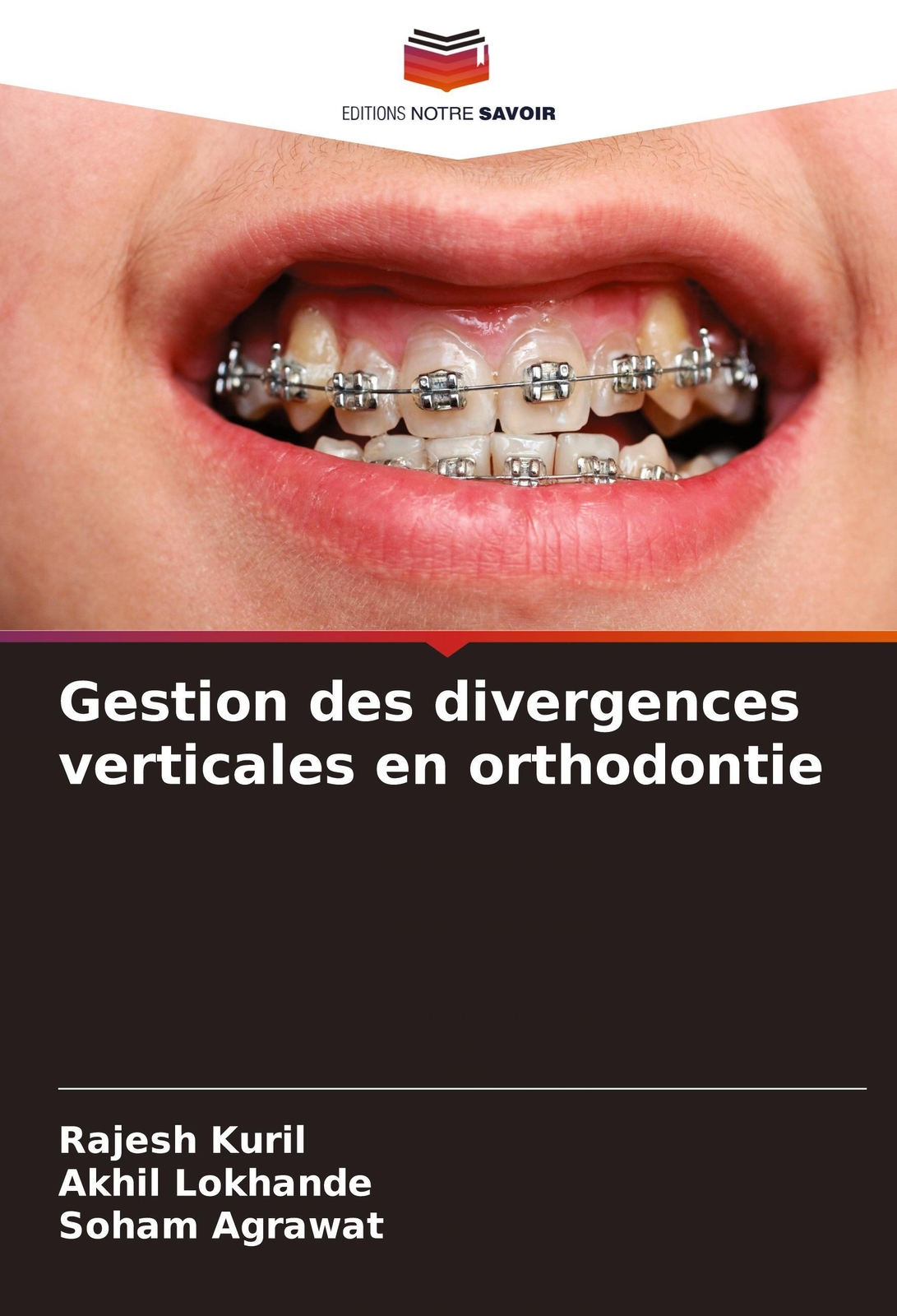 Thumbnail - Rajesh Kuril (u. A.) | Gestion Des Divergences Verticales En