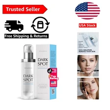 All-in-One Dark Spot Treatment Serum - Perfect for All Skin Types - 1.0 Fl Oz