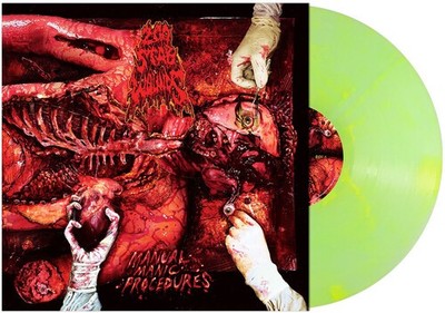 200 Stab Wounds - (PRESALE 6/12/26) Manual Manic Procedures (GREEN YELLOW VINYL)
