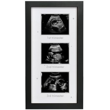 Ultrasound Picture Frame - Triple Sonogram Frame for Mom to Be  Pregnancy Ph...