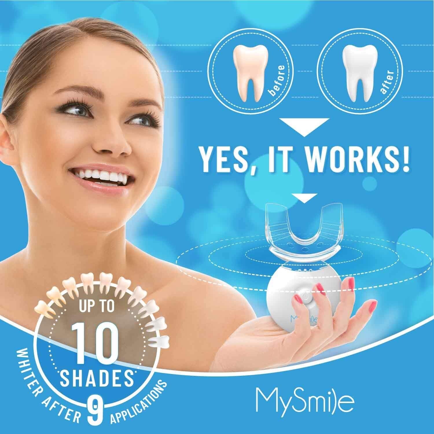MySmile Teeth Whitening Kit with LED Light, 10 Min NonSensitive Fast