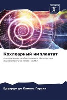 Eduardo De Kampos Garsiq | Kohlearnyj Implantat | Taschenbuch | Russisch (2022)