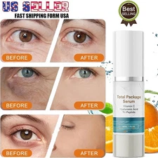 NEW Total Package Serum, All-In-One Vitamin C, Hyaluronic Acid, Peptides Serum