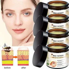 Bee Venom Skin Tag Removal Treatment Cream Body Care Mole Corn Wart Remover-2025