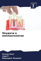 Saguna Kaul (U. A.) | Neudachi W Implantologii | Taschenbuch | Russisch (2023)