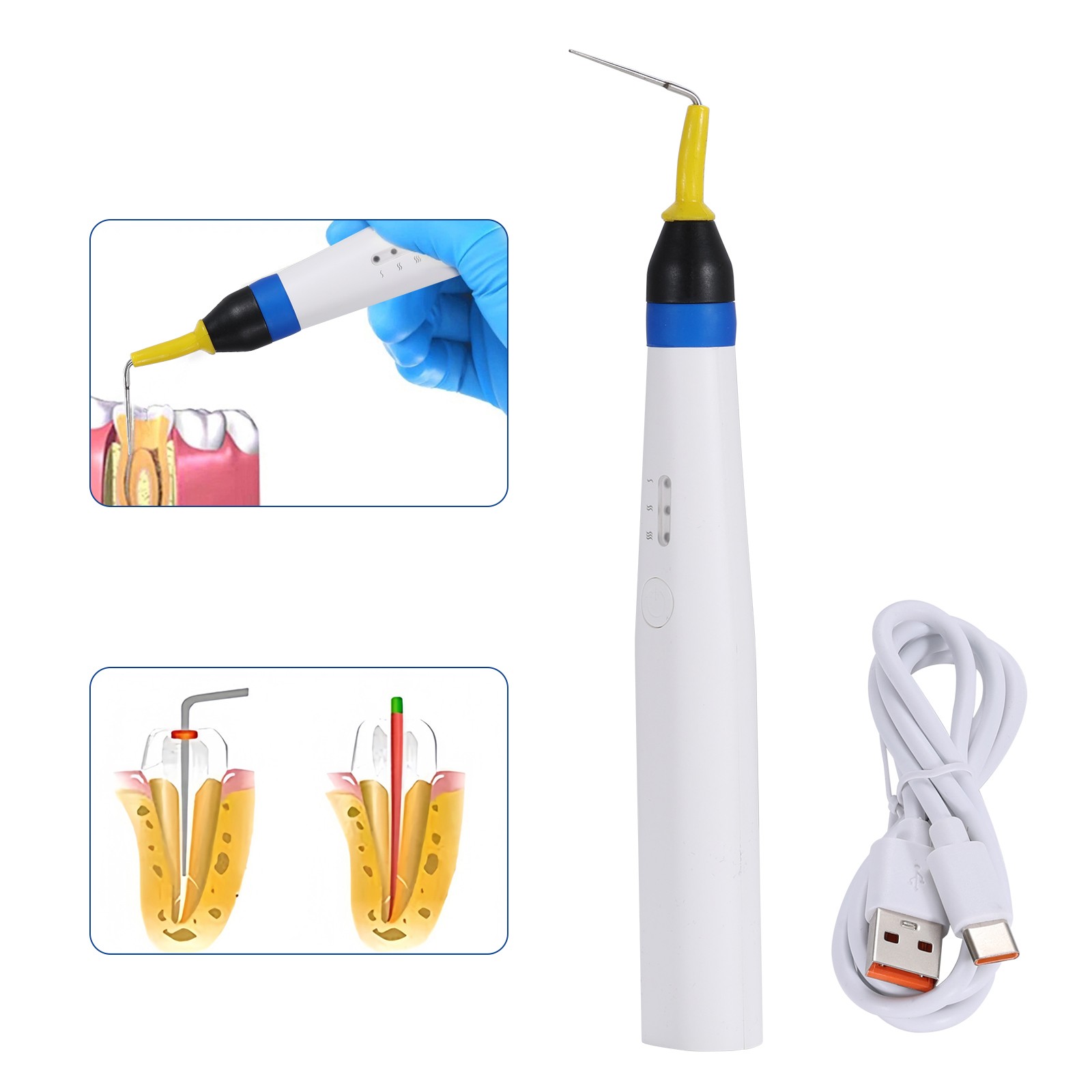 Dental Cordless Gutta Percha Obturation System Endo Heated Pen With 2 Tips Kit