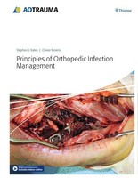 Principles Of Orthopedic Infection Management Stephen Kates