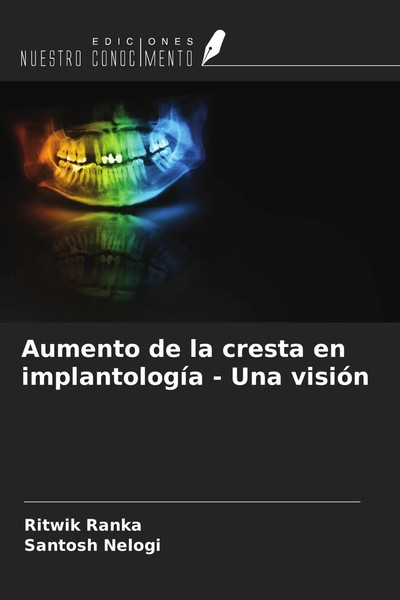 Ritwik Ranka (U. A.) | Aumento De La Cresta En ImplantologíA - Una VisióN | Buch-image