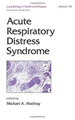 Acute Respiratory Distress Syndrome Hardcover Michael A. Matthay