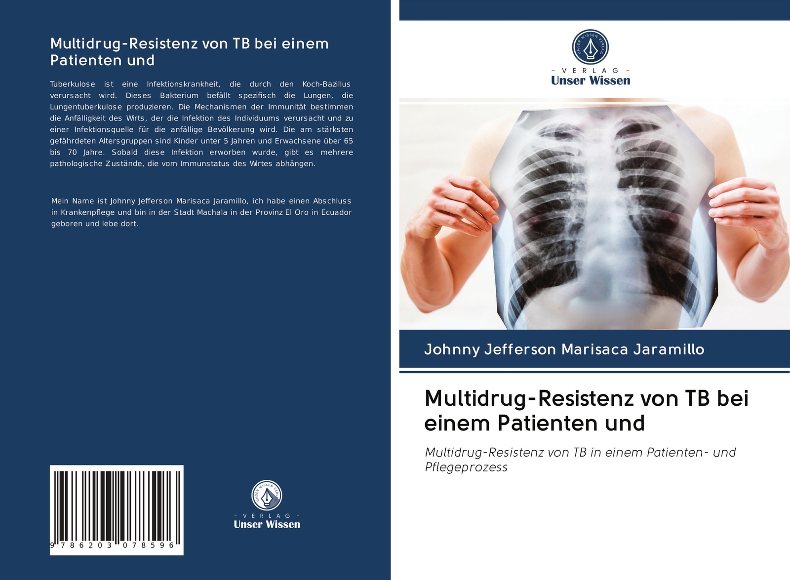 Thumbnail - Multidrug-resistenz Von Tb Bei Einem Patienten Und Jaramillo