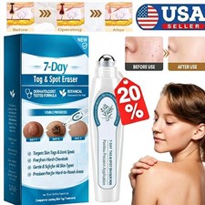 Skin Tag Remover,Picdo Tag and Spot Eraser,Skin Tag Dark Spot Remove US STOCK