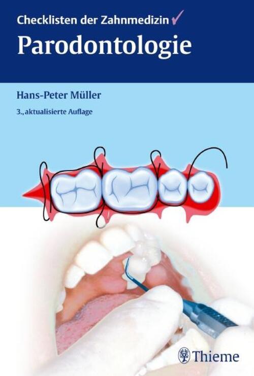 Hans-peter Müller | Checklisten Der Zahnmedizin Parodontologie | Buch