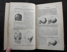 1838 DR ROGET, ON THE FUNCTIONS of THE CEREBELLUM, PHRENOLOGY, GEORGE COMBE