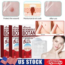 45 PCS Microneedle Botanic Skin Tag  Acne Patch Skin Tag Remover Patches HOT