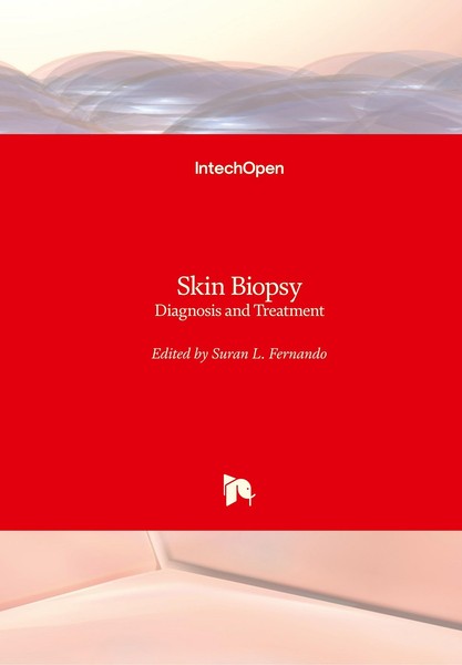 Skin Biopsy Suran Fernando-image