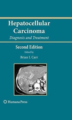Hepatocellular Carcinoma: Diagnosis and Treatment (Current Buch Humana Press