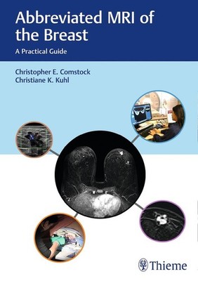 Abbreviated MRI of the Breast | Christopher E Comstock, Christiane Kuhl