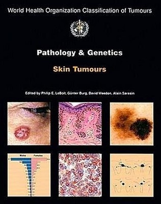 Pathology and Genetics of Skin Tumours (World Organization Classification o ...