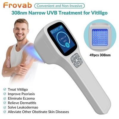 Portable Home Phototherapy 49 Diodes 308nm UVB Light Skin Diseases Excimer Light