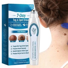 Tag Spot Eraser Mole Skin Tags Removal Tool Roll  on Serum Eraser Pen Painless