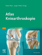 Atlas Kniearthroskopie: Mit Zugang Buch Urban...