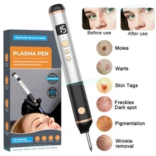 Plasma Pen Physically Skin Tag & Mole Remover 15 Level Laser Spot Removal Device