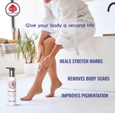 ACE Body Lotion