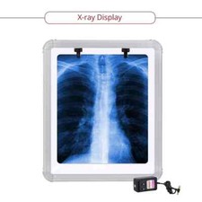 LED X-Ray Film Viewer Box SMALL(14''X17'') LARGE with free shipping