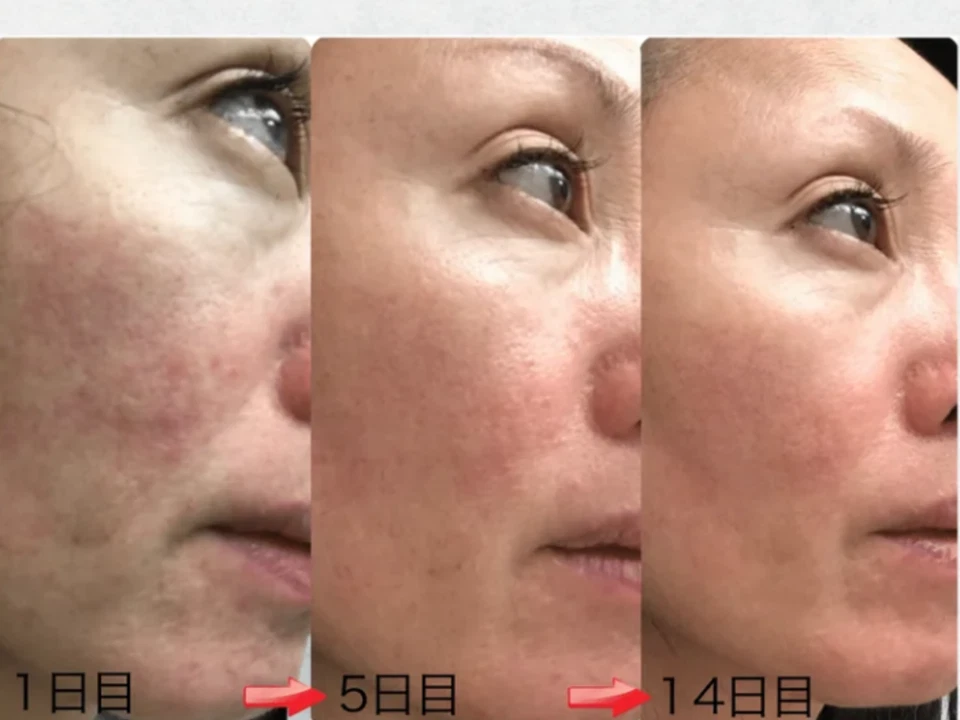 Majestic Skin - 20% Human Stem Cells Regenerative Serum from Japan 5ml - Image 3 of 4