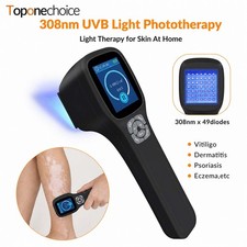 308nm Narrowband Excimer UVB Device Portable Handheld Skin Care Therapy Home Use