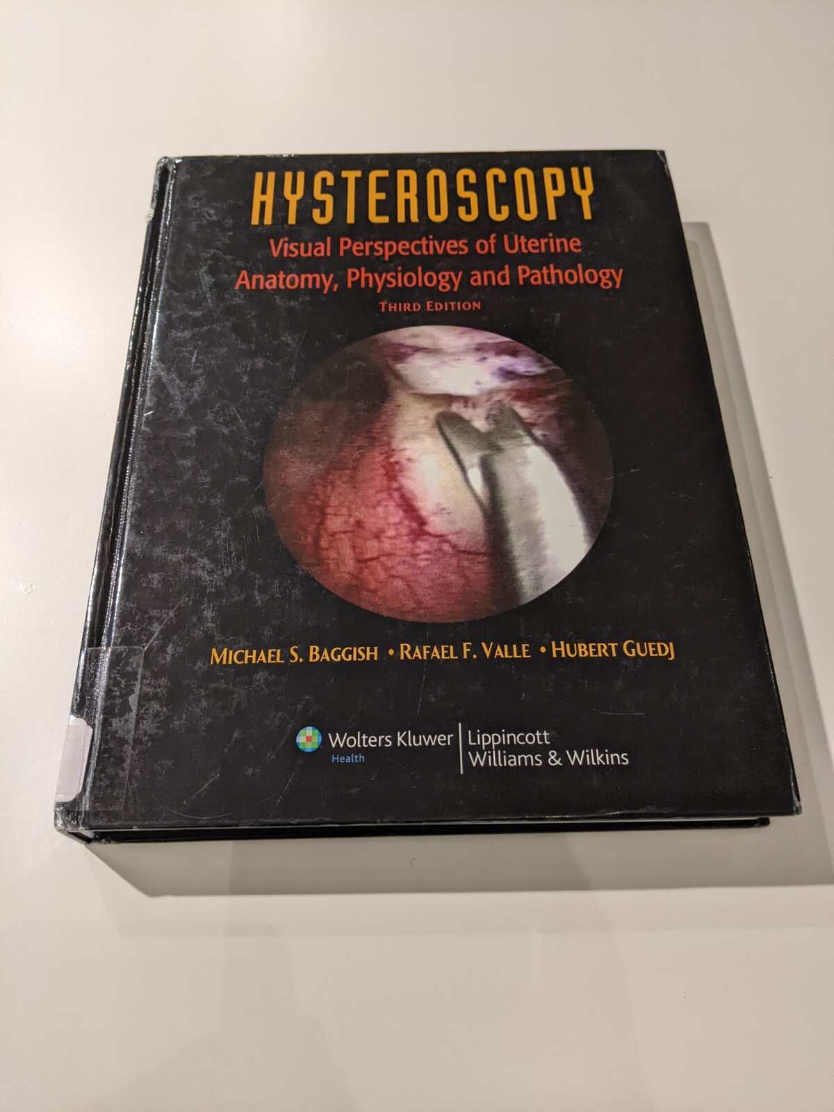 Hysteroscopy Visual Perspectives of Uterine Anatomy Physiology and Pathology