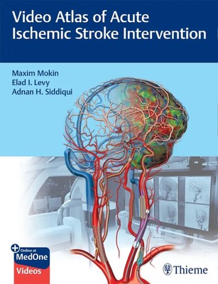 Video Atlas of Acute Ischemic Stroke Intervention Maxim Mokin (u. a.) Bundle