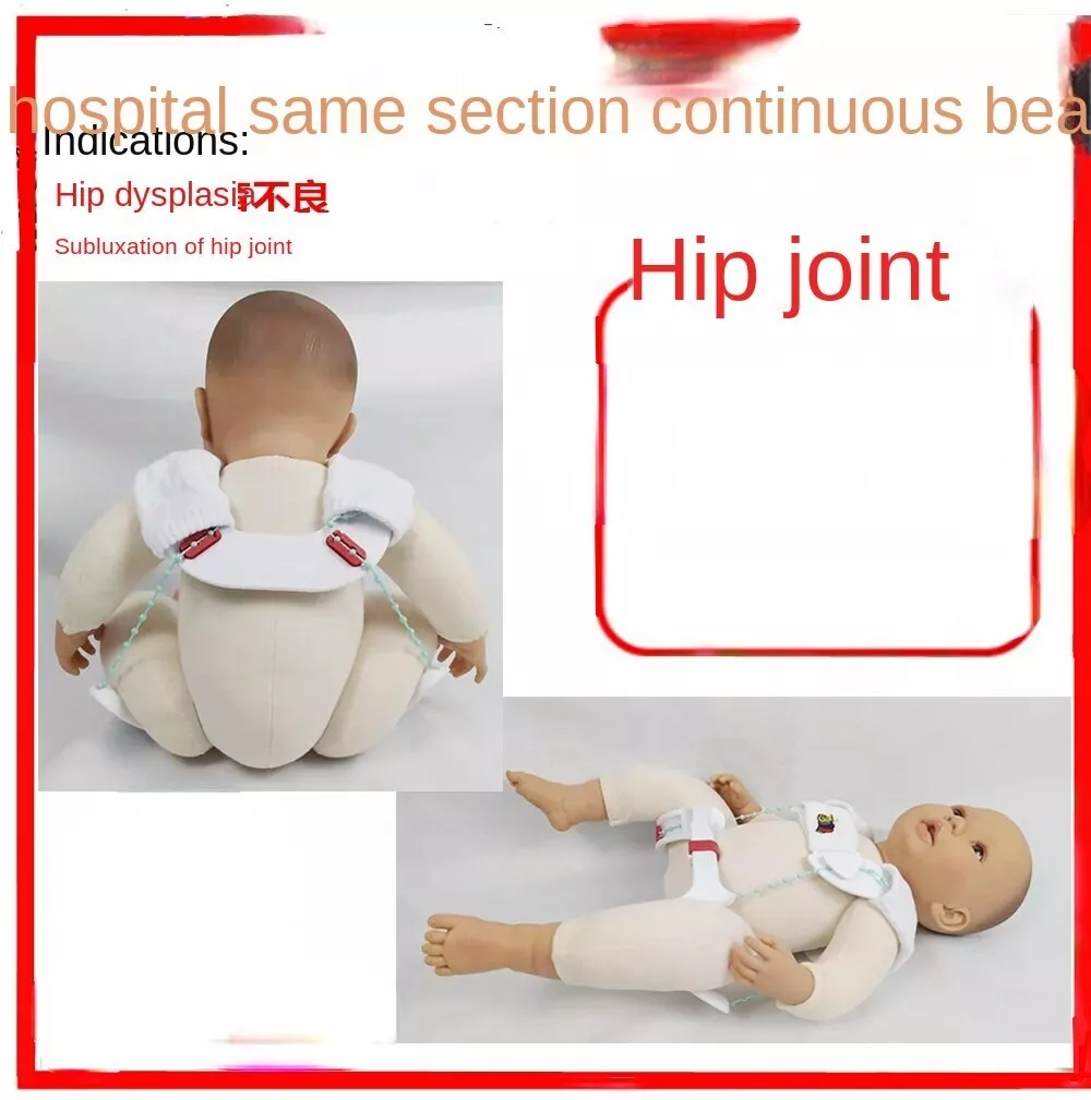 Hip fixation support dysplasia orthosis children's frog abduction