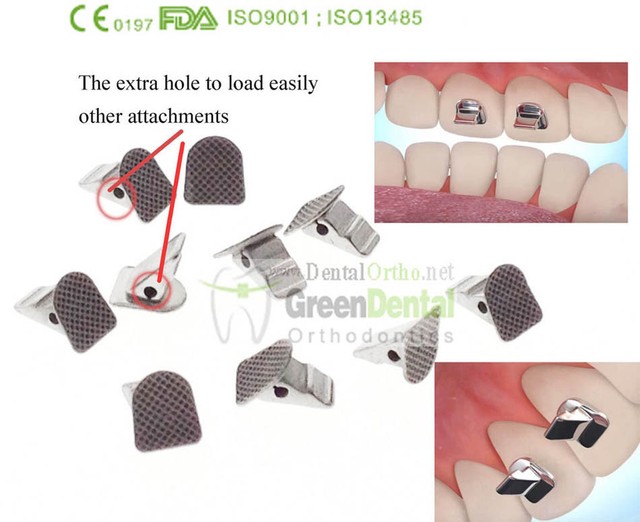 10/PK Bite Turbos Dental Orthodontic Molar Band Niti Archwire Buccal