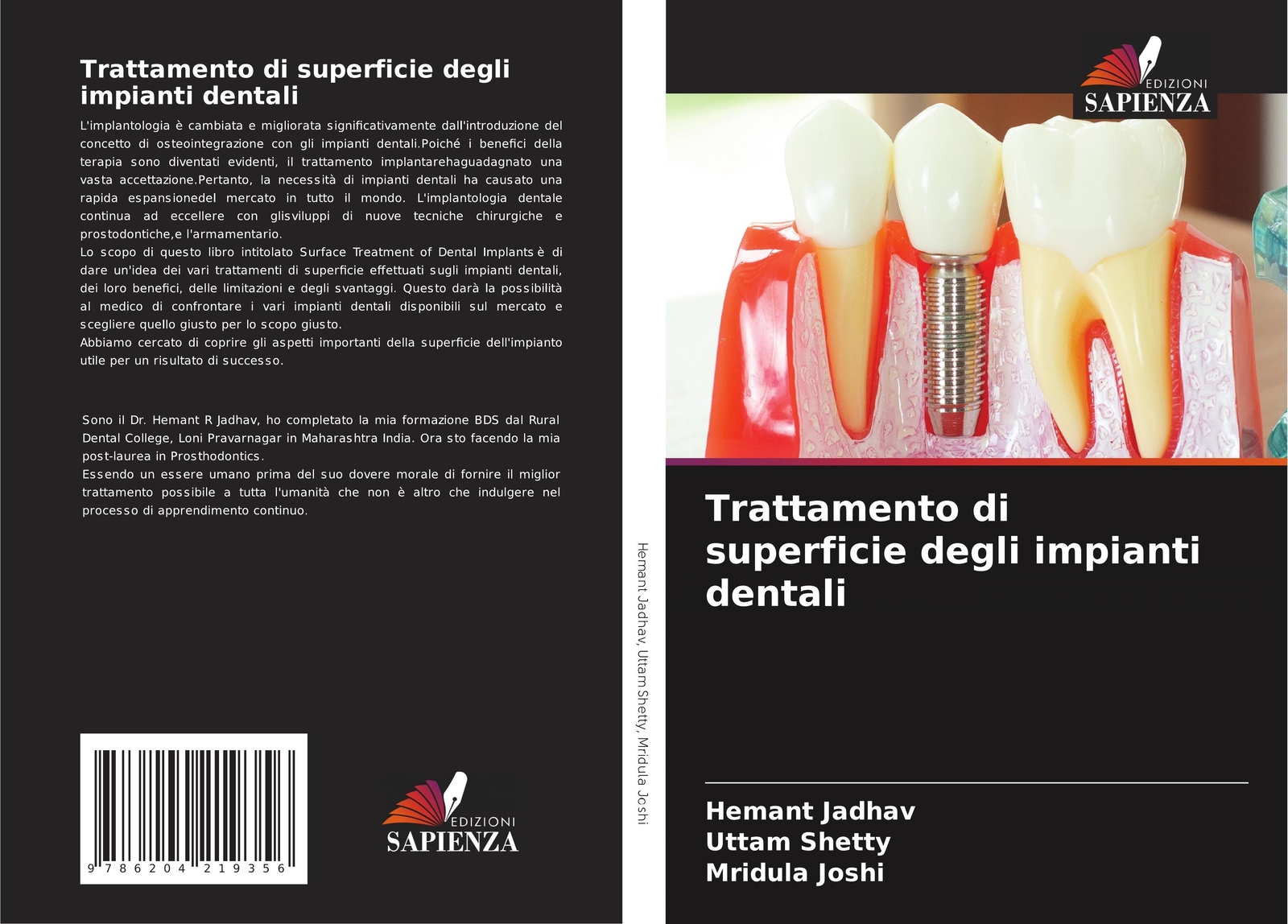 Thumbnail - Trattamento Di Superficie Degli Impianti Dentali | Hemant Jadhav (u.