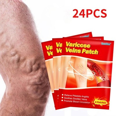 24Pcs/4Bags Varicose Veins Plaster Vasculitis Phlebitis Spider Leg Medical Patch