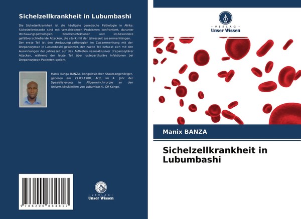 Manix Banza | Sichelzellkrankheit In Lubumbashi | Taschenbuch | Deutsch (2020)-image
