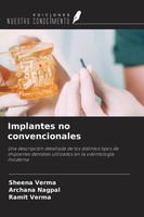 Sheena Verma (U. A.) | Implantes No Convencionales | Taschenbuch | Spanisch