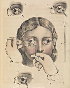 Vintage Medical Charts