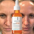 Roche-Posay Vitamin C Face Serum Anti-Dark Spot Skin Brightener 30ml,Exp.01/27