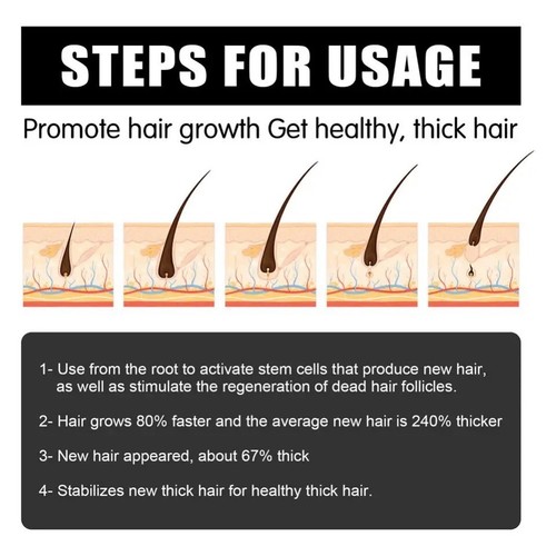 Beard Derma Roller For Hair Loss Beard Growth Derma Roller micro Growth Serum - Picture 22 of 24